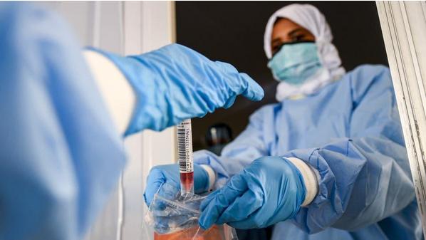 55وفاة و7705 إصابة جديدة بفيروس كورونا في الأردن  