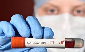 تسجيل 15 إصابة جديدة بفيروس كورونا في الأردن منها واحدة محليّة