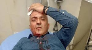 الإعتداء على الصحفي الحباشنة جريمة بحق الوطن 